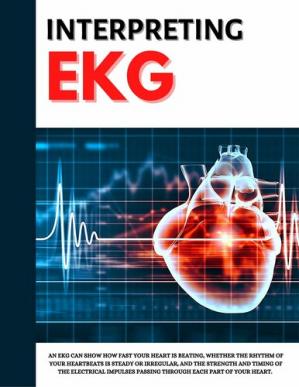 free-pdf-download-Interpreting EKG EKG Interpretation For Nurses