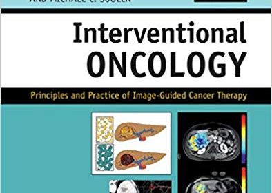 free-pdf-download-Interventional Oncology: Principles and Practice of Image-Guided Cancer Therapy 2nd Edition