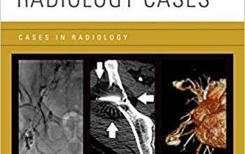 free-pdf-download-Interventional Radiology Cases (Cases in Radiology) 1st Edition