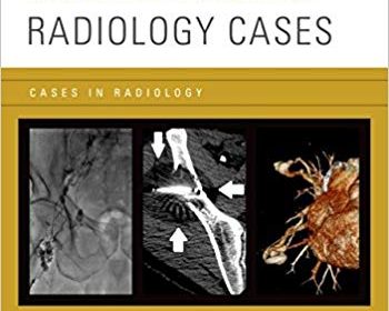 free-pdf-download-Interventional Radiology Cases (Cases in Radiology) 1st Edition