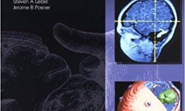 free-pdf-download-Intracranial Tumors: Diagnosis and Treatment