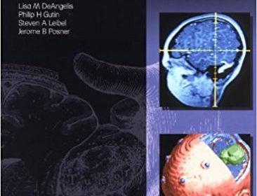 free-pdf-download-Intracranial Tumors: Diagnosis and Treatment