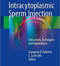 free-pdf-download-Intracytoplasmic Sperm Injection: Indications