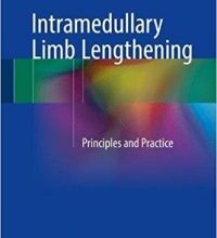 free-pdf-download-Intramedullary Limb Lengthening: Principles and Practice 1st ed. 2018 Edition