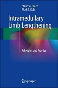 free-pdf-download-Intramedullary Limb Lengthening: Principles and Practice 1st ed. 2018 Edition