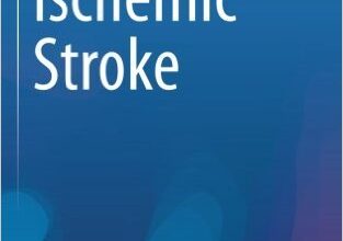 free-pdf-download-Ischemic Stroke (Emergency Management in Neurology) 1st ed. 2017 Edition