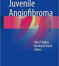 free-pdf-download-Juvenile Angiofibroma 1st ed. 2017 Edition