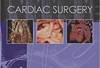 free-pdf-download-Key Questions in Cardiac Surgery 1st Edition