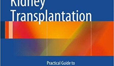 free-pdf-download-Kidney Transplantation: Practical Guide to Management 2014th Edition