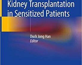 free-pdf-download-Kidney Transplantation in Sensitized Patients