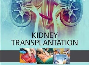 free-pdf-download-Kidney Transplantation – Principles and Practice: Expert Consult – Online and Print 8th Edition