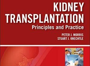 free-pdf-download-Kidney Transplantation – Principles and Practice: Expert Consult – Online and Print (Morris