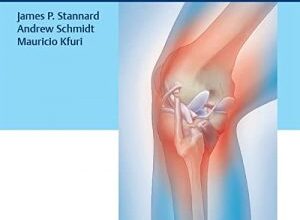 free-pdf-download-Knee Surgery: Tricks of the Trade