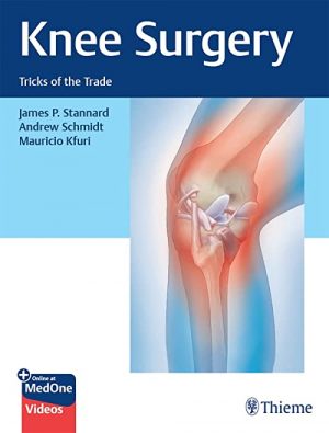 free-pdf-download-Knee Surgery: Tricks of the Trade