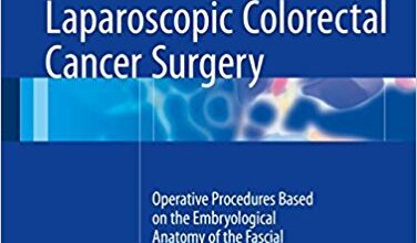 free-pdf-download-Laparoscopic Colorectal Cancer Surgery: Operative Procedures Based on the Embryological Anatomy of the Fascial Composition 1st ed. 2017 Edition