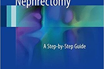 free-pdf-download-Laparoscopic Donor Nephrectomy: A Step-by-Step Guide 1st ed