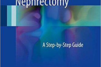 free-pdf-download-Laparoscopic Donor Nephrectomy: A Step-by-Step Guide 1st ed. 2017 Edition