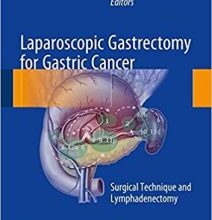 free-pdf-download-Laparoscopic Gastrectomy for Gastric Cancer: Surgical Technique and Lymphadenectomy