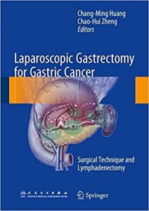 free-pdf-download-Laparoscopic Gastrectomy for Gastric Cancer: Surgical Technique and Lymphadenectomy