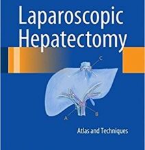 free-pdf-download-Laparoscopic Hepatectomy: Atlas and Techniques