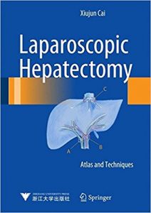 free-pdf-download-Laparoscopic Hepatectomy: Atlas and Techniques