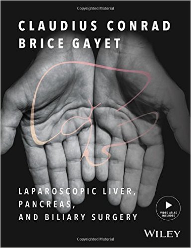 free-pdf-download-Laparoscopic Liver