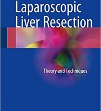 free-pdf-download-Laparoscopic Liver Resection: Theory and Techniques 1st ed