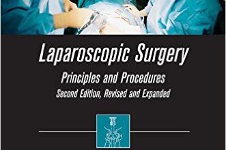 free-pdf-download-Laparoscopic Surgery: Principles and Procedures