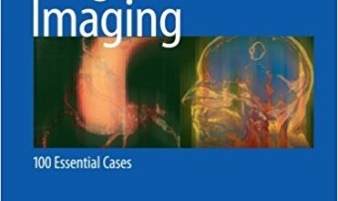 free-pdf-download-Learning Diagnostic Imaging: 100 Essential Cases (Learning Imaging)