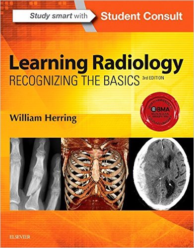 free-pdf-download-Learning Radiology: Recognizing the Basics