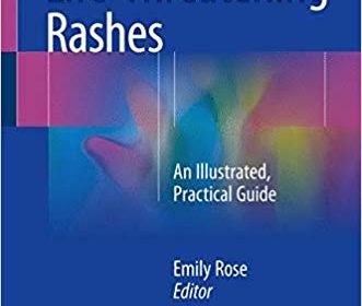 free-pdf-download-Life-Threatening Rashes: An Illustrated