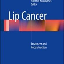 free-pdf-download-Lip Cancer: Treatment and Reconstruction