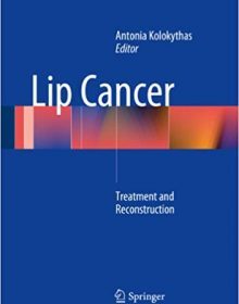 free-pdf-download-Lip Cancer: Treatment and Reconstruction