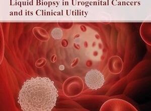 free-pdf-download-Liquid Biopsy in Urogenital Cancers and its Clinical Utility