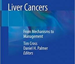 free-pdf-download-Liver Cancers: From Mechanisms to Management