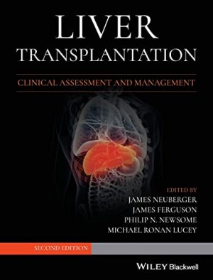 free-pdf-download-Liver Transplantation: Clinical Assessment and Management 2nd Edition