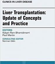 free-pdf-download-Liver Transplantation: Update of Concepts and Practice