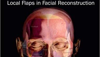 free-pdf-download-Local Flaps in Facial Reconstruction: Text with DVD 2nd Edition