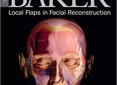 free-pdf-download-Local Flaps in Facial Reconstruction: Text with DVD 2nd Edition