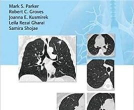 free-pdf-download-Lung Cancer Screening 1st Edition