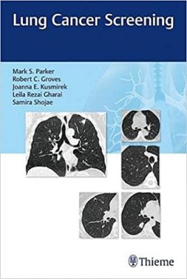 free-pdf-download-Lung Cancer Screening 1st Edition