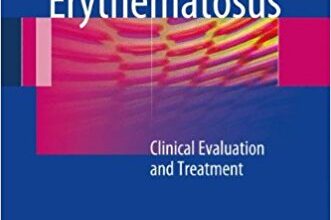 free-pdf-download-Lupus Erythematosus: Clinical Evaluation and Treatment 2012th Edition