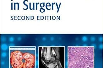 free-pdf-download-MCQs and EMQs in Surgery: A Bailey & Love Revision Guide