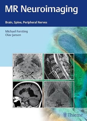 free-pdf-download-MR Neuroimaging: Brain