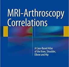 free-pdf-download-MRI-Arthroscopy Correlations: A Case-Based Atlas of the Knee