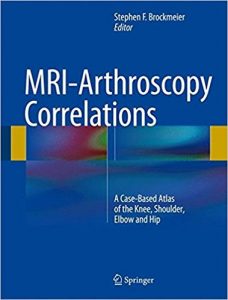 free-pdf-download-MRI-Arthroscopy Correlations: A Case-Based Atlas of the Knee