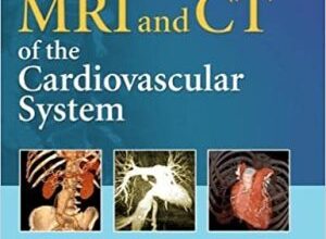 free-pdf-download-MRI and CT of the Cardiovascular System Third Edition