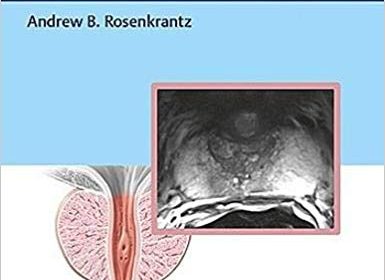 free-pdf-download-MRI of the Prostate: A Practical Approach 1st Edition