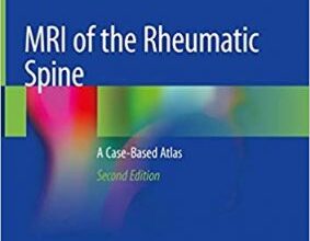 free-pdf-download-MRI of the Rheumatic Spine: A Case-Based Atlas 2nd ed