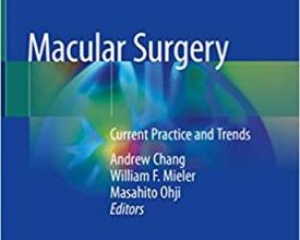 free-pdf-download-Macular Surgery: Current Practice and Trends